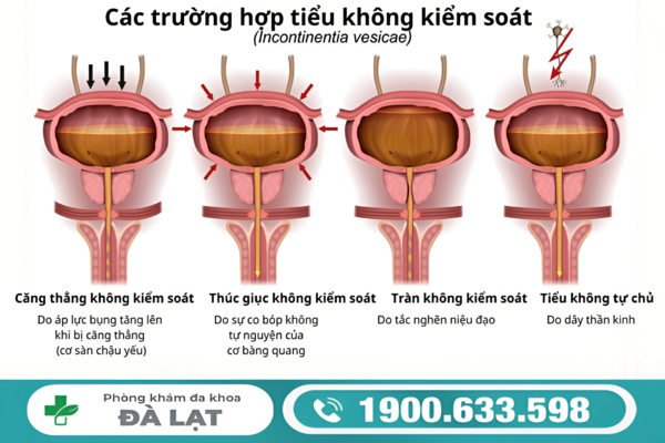 Hình ảnh minh họa